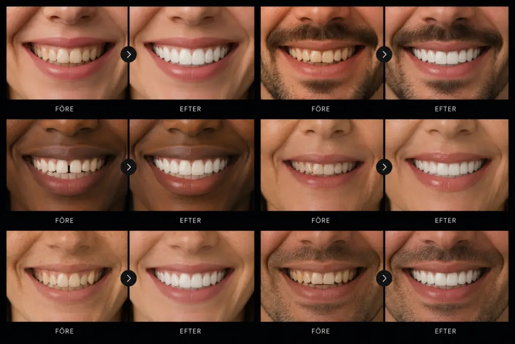 Row of close-up smiles showing before-and-after teeth whitening results on diverse individuals.