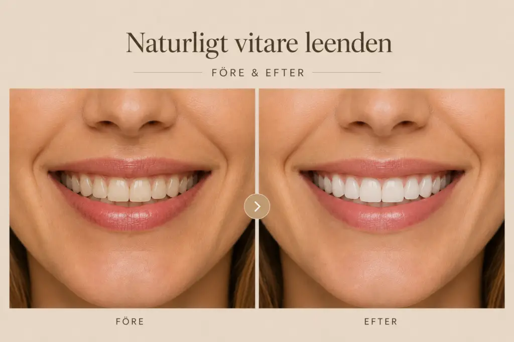 Side-by-side before-and-after photo showing brighter, whiter teeth after whitening treatment